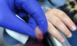 3 yaşlı uşağın əli eskalatorda qaldı -  Barmağı kəsildi