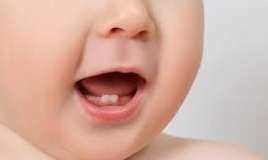 Uşağın dişləri neçə yaşına kimi çıxmalıdır? - CƏDVƏL