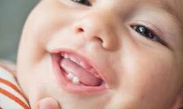 Körpələrdə dişçıxarma dövrü:  Valideynləri narahat edən əsas səbəblər və təhlükəsiz həll yolları