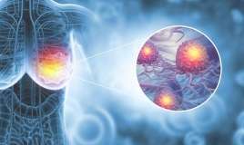 Mamoqrafiya “təmiz” olsa da, xərçəng necə aşkarlandı? -  Real pasiyent hekayəsi-VİDEO