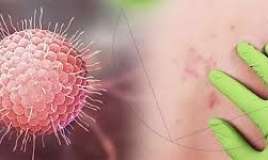 Bu virus bədəndə on illərlə yaşaya    bilər