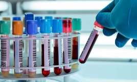 İşə qəbulda narkoloji rəy  təqdim ediləcək