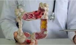 Bədəndə xoşxassəli düyünlər niyə yaranır?  