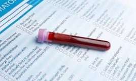  Azərbaycanda heç kim yoxlatmır - Ən vacib gizli analiz