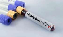 Hantavirus hansı ölkələrdə aşkarlanıb? -  Yoluxma artır