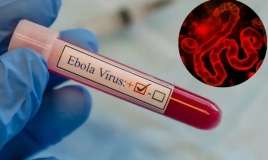 Ebola virusundan 139 nəfər ölüb - RƏSMİ