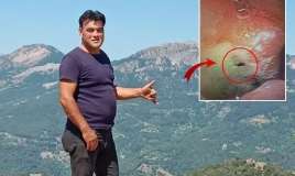 Kabus kimi bir hadisə -  Mədəsindən canlı həşərat çıxarıldı