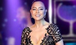 Ebru Gündeş estetik əməliyyatdan sonra... -   Görənlər şokda