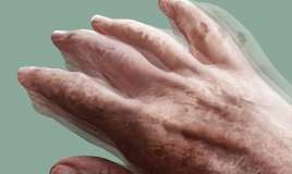 7 il Parkinson xəstəliyi ilə yaşayan pasiyentin mübarizə hekayəsi -  VİDEO