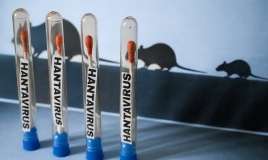 Hantavirus epidemiyası 2 iyulda bitəcək? 