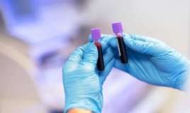 Vazopressin nədir? -  Kişilərdə vazopressin hormonu