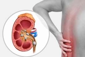 Hər gün bir ovuc yeyin:  Böyrək daşlarını atmağa kömək edir