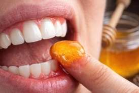 Təbii müalicə -   Diş ətlərinə bal çəkmək sizi diş həkimindən xilas edir