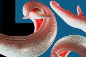 Bədənimizdəki hansı qurdlar   - vitaminlərimizi "yeyir"?