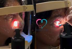 Şagirdin istifadə etdiyi ağardıcı partladı -  Gözü zədələndi - VİDEO