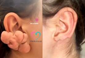 Sırğadan sonra qulağı bu hala düşdü -  VİDEO