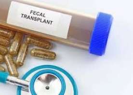 Nəcis transplantasiyası autizmi    müalicə edə bilər