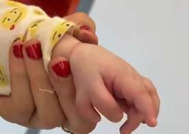 Əldə artıq barmaq nədəndir? -  Həkim açıqladı