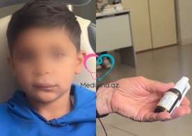 Boğaz spreyindən sonra uşağın üzü  dəhşətli hala düşdü - VİDEO