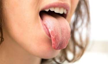 Dilin rəngi hansı xəstəliklərdən xəbər verir? 