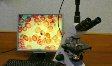 Qanın qaranlıqsahəli mikroskopiyası  analizi  - Nəyi göstərir?