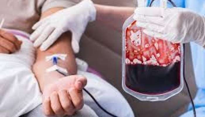 Qanköçürmə də orqan transplantasiyasına bərabərdir 