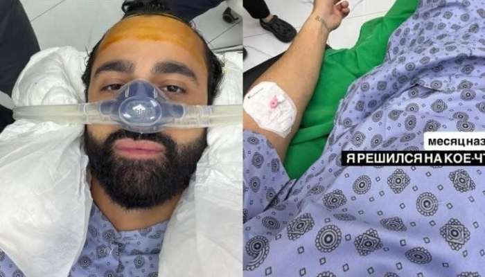 Hüseyn saç əkdirdi -  FOTO