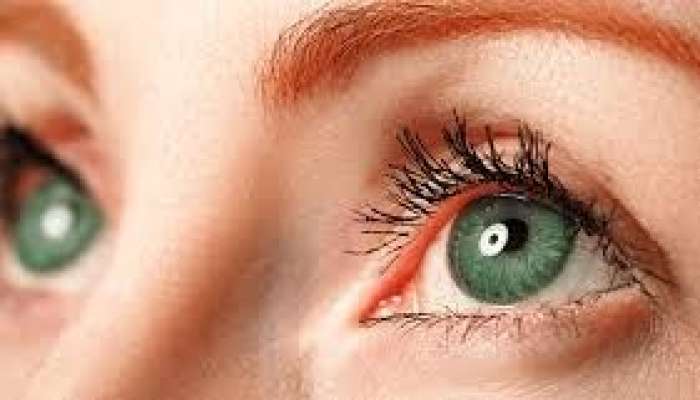 Şəkər xəstəliyinin gözlərinizdəki əlamətləri 