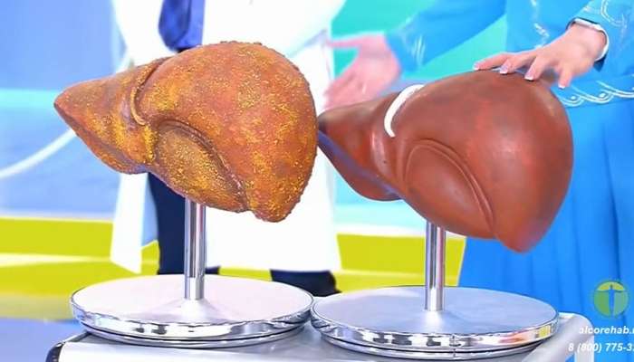 Kimin qaraciyərini araq tez sıradan çıxarır? 