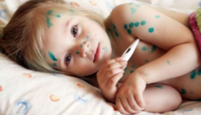 Su çiçəyinə yoluxmada artım  