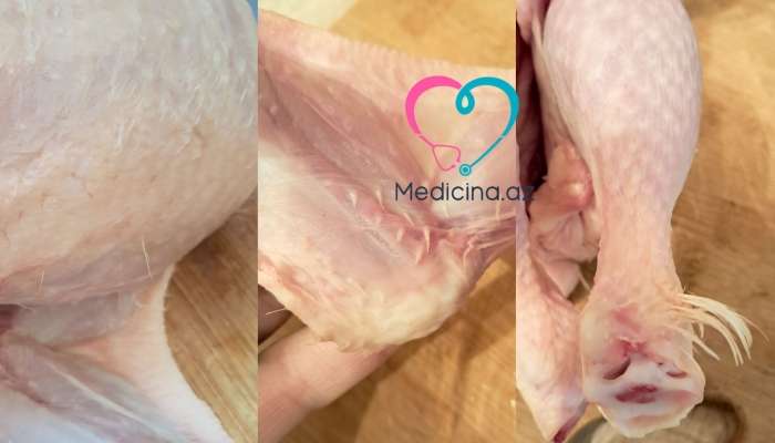 Tükü yaxşı yolunmamış broyler toyuqları təhlükəlidir? -  Açıqlama