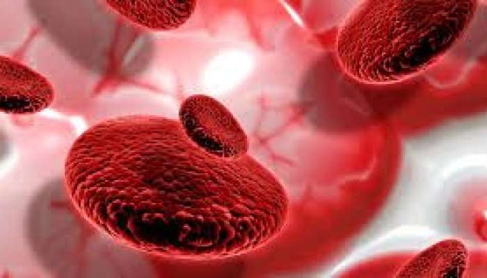 Hemoqlobini dərmansız artırmağın   -  qeyri-adi yolu