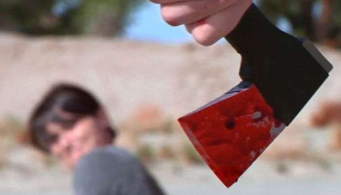 Əmisi tərəfindən baltalanan azyaşlının vəziyyəti açıqlandı 