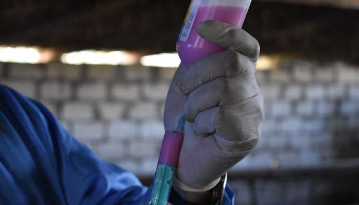 Bu xəstəliklərə qarşı peyvəndləmə tədbirlərinə başlanıldı -  FOTO