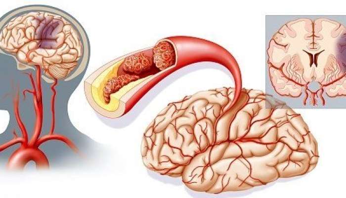 Sinir sisteminin düzgün işləmədiyinin    əsas əlamətləri