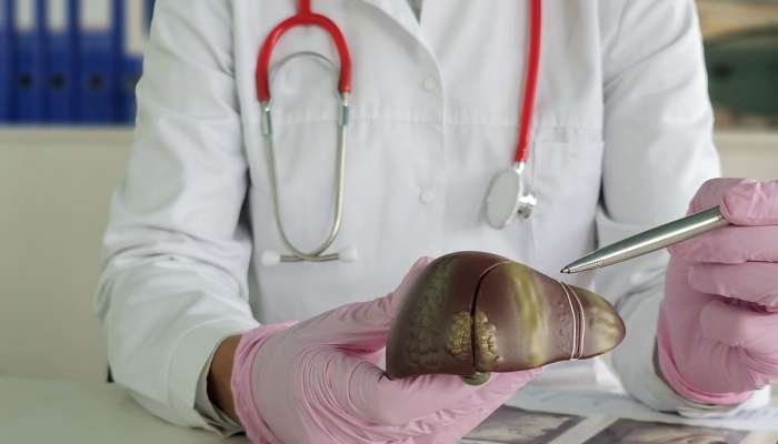 Axşam 21:00-dan sonra yemək  – qaraciyərdə fibroz yaradır