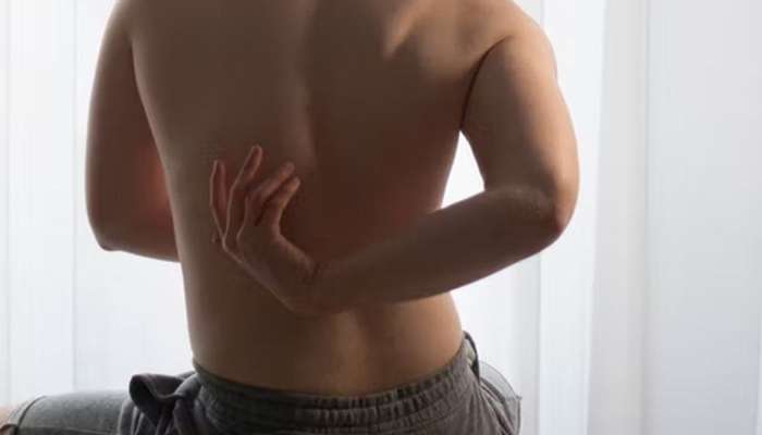 Bel ağrıları üçün MRT mənasızdır  – Məşhur həkim