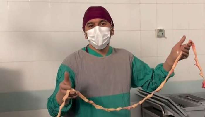 Qadından çıxarılan miomanın ölçüsü hər kəsi təəccübləndirdi -  VİDEO