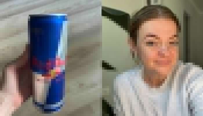 2 həftə energetik içki içən qadının  -  qaraciyəri zədələndi