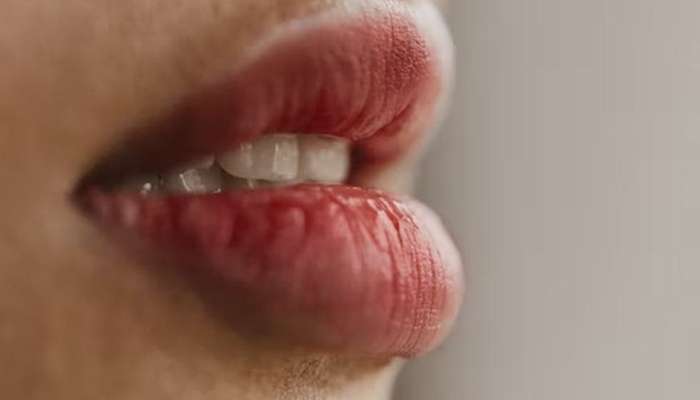 Dodaqlar çatlayırsa  – autoimmun xəstəlikdən yoxlan 