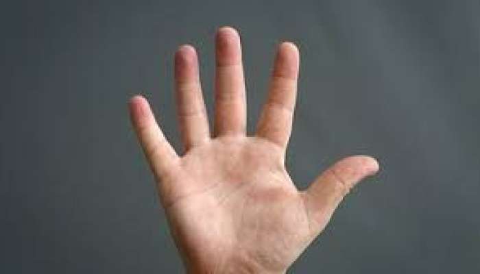 Yağlı qaraciyər xəstəliyi  – Ovuclarına bax