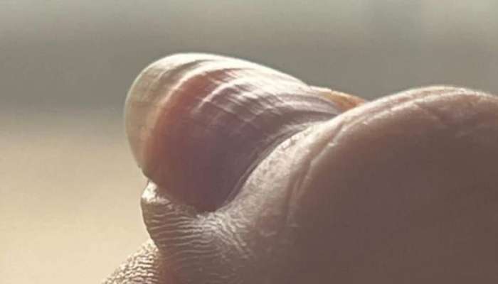 Dalğalı dırnaqlar görün nəyi göstərir -  Bədən həyəcan siqnalı verir