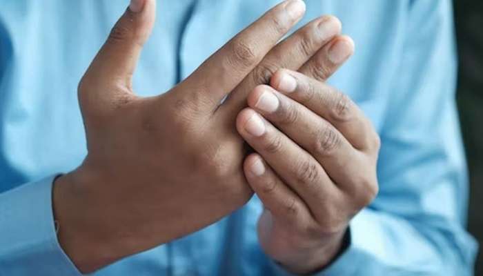 Oynaq ağrısı yağlı qaraciyərdəndir  – Yoxlan