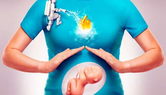 Mədə yanması müalicə olunmazsa, nə olar?  – Onkoloq