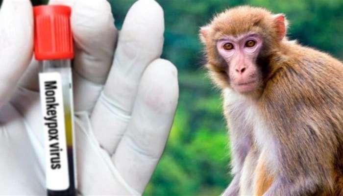 Taylanddan qayıdan turistlərdə meymunçiçəyi    aşkarlandı