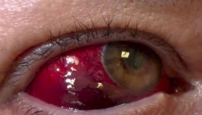 Qadının gözü zədələndi -  Dəhşətli hala düşdü - VİDEO