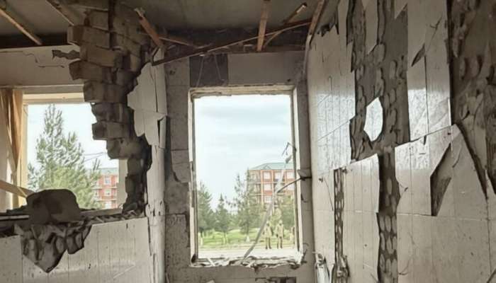 İranın Naxçıvana hücumu nəticəsində  xəsarət alanların son durumu