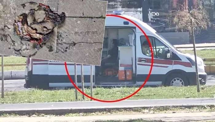Helium şarlar bomba kimi partladı -  2 uşaq yaralandı-FOTO
