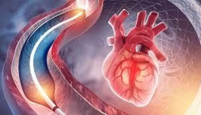 Ürək damarlarının tutulduğunu göstərən    8 əsas əlamət