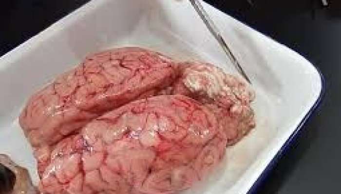 Beyində qurd və parazitlər  - Əlamətlər